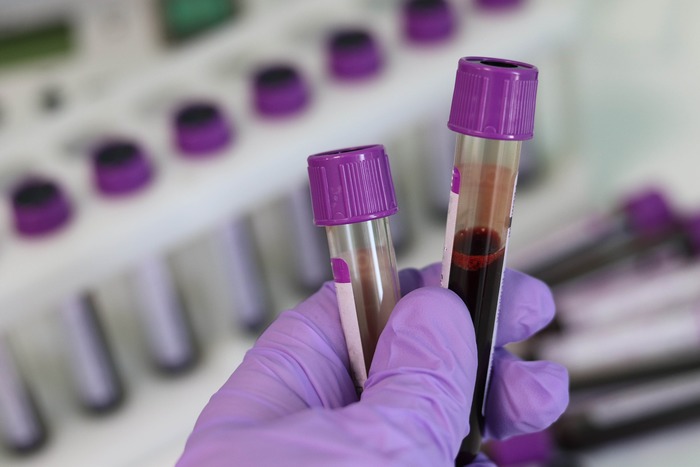 laboratory-gaf83468a9_1920.jpg