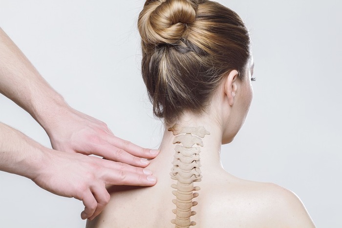 kyphotic_deformity2.jpg kyphotic_deformity2.jpg