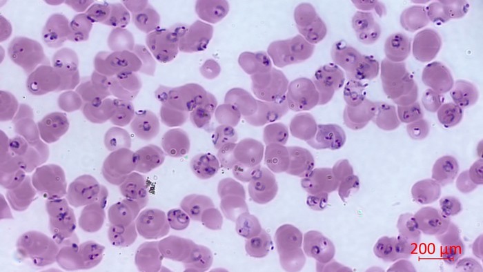 cienki_rozmaz_krwi_malaria.jpg