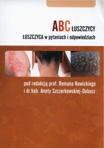 abc-luszczycy-luszczyca-w-pytaniach-i-odpowiedziach.png abc-luszczycy-luszczyca-w-pytaniach-i-odpowiedziach.png